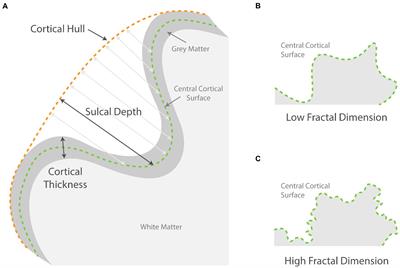 The complex interplay of hypoxia and sleep disturbance in gray matter structure alterations in obstructive sleep apnea patients